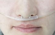 Stages of COPD