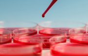 Anemia and COPD