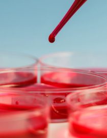What Are the Risks of Anemia and COPD? What Are the Risks of Anemia and COPD?