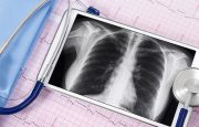 COPD Research