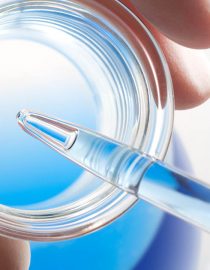 Could Stem Cell Therapy Help Treat COPD? Could Stem Cell Therapy Help Treat COPD?